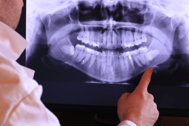 Best Urgent Care for Lost Fillings or Crowns in New Britain, CT